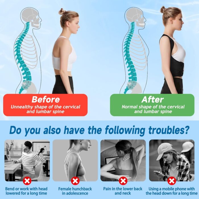 Chest Posture Corrector | Scoliosis Back Brace | Spine Belt & Shoulder Support - Image 5